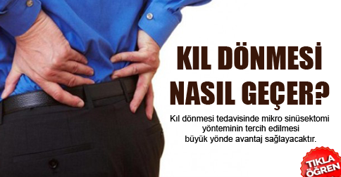 kil-donmesi-nasil-gecer